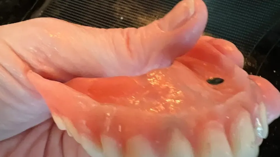 Affordable Dentures & Implants - Dentist in Jackson, MS
