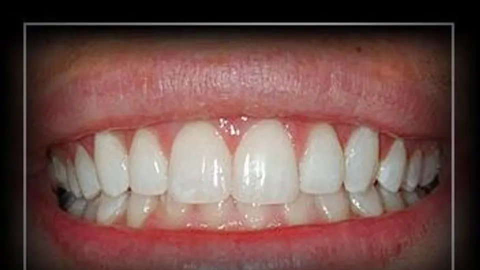 Annapolis Periodontics - Periodontist in Annapolis, MD