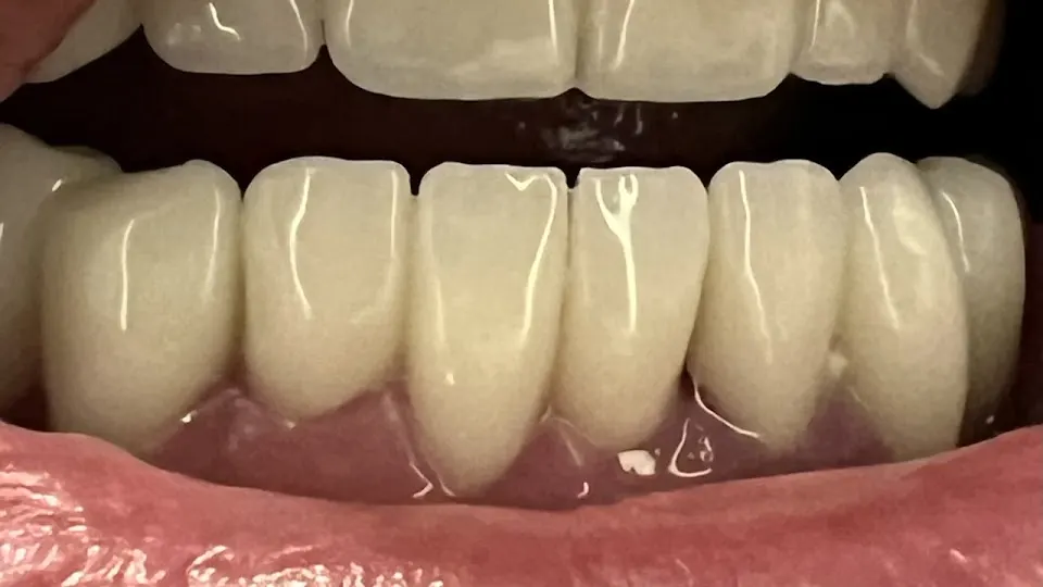 Bloomington Dental Group - Dentist in Bloomington, IN