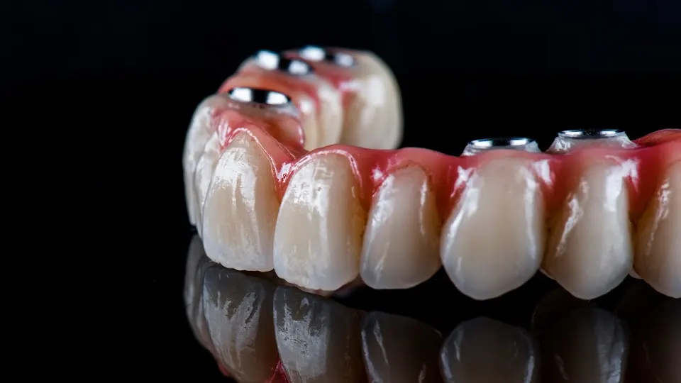 Bone Dental Lab - Dental laboratory in Bozeman, MT