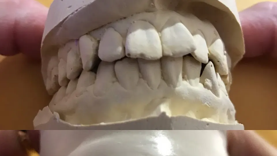 Central Valley Dentistry & Implants - Dentist in Phoenix, AZ