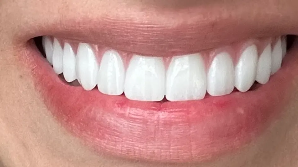 ClearChoice Dental Implant Center - Nashville - Dental implants provider in Nashville, TN