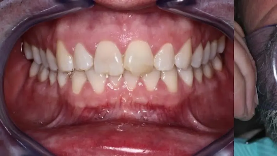 Dental Care of Jackson Hole - Dentist in Jackson, WY