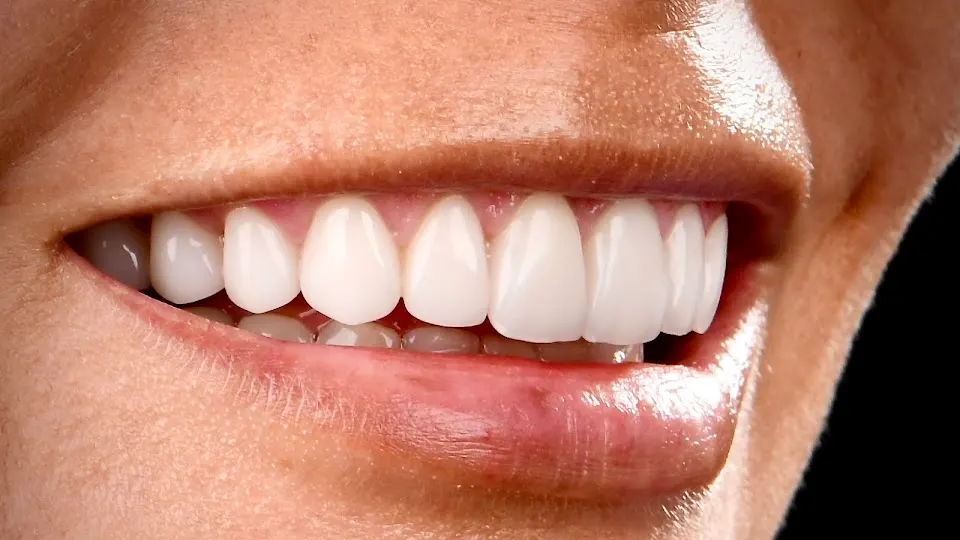 Dental Illusions - Cosmetic dentist in Houston, TX