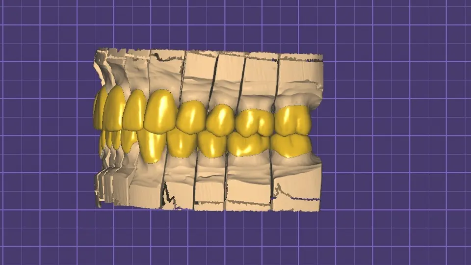 FATHOM DENTAL STUDIO - Dental laboratory in Walla Walla, WA