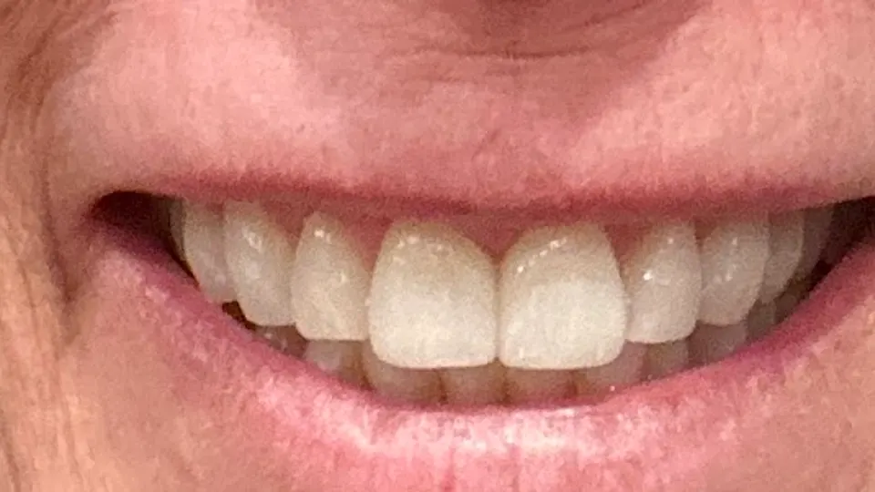 Freeman Smiles - Cosmetic dentist in Bend, OR