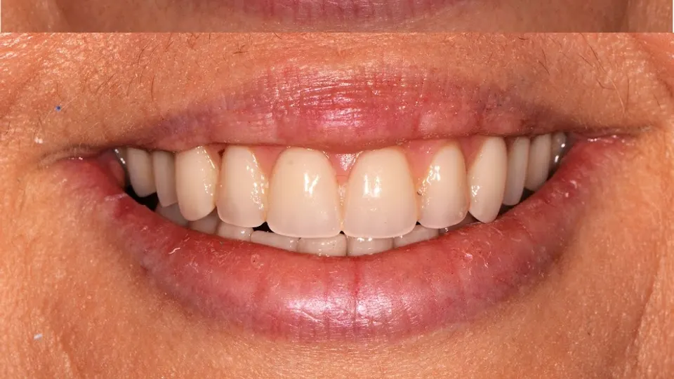 Honolulu Smile Design - Dentist in Honolulu, HI