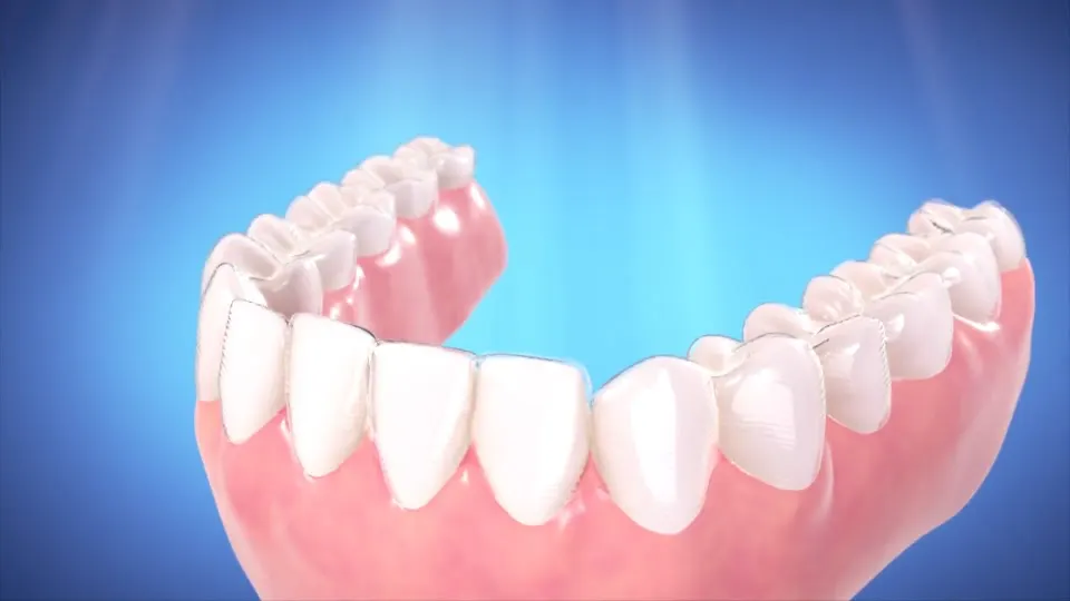 Island Dental - Dentist in Key West, FL