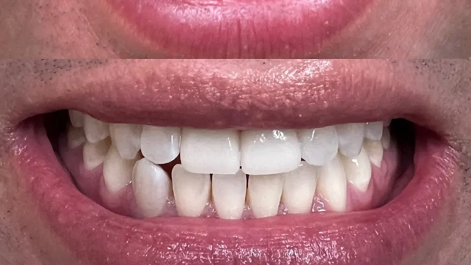 Lakeshore Dental - Dentist in Minneapolis, MN