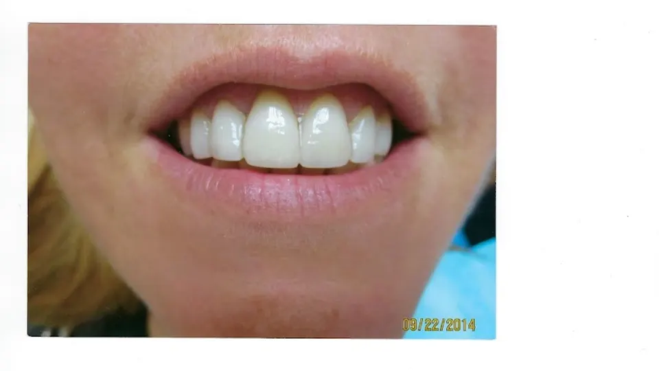 Lesley R. Rosenthal, DDS, PC - Cosmetic dentist in New York, NY