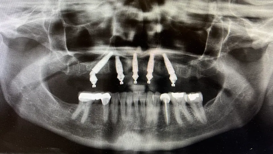 Monterey Dental Implant Center - Dentist in Monterey, CA