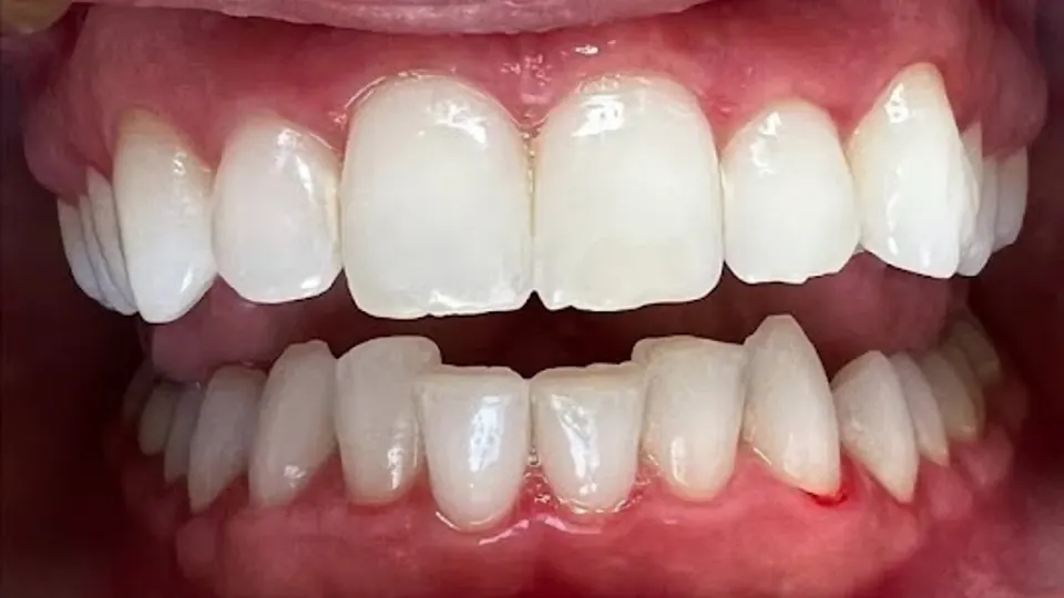 Mountain Ridge Dental - Dentist in Bozeman, MT