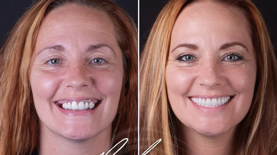 My New Smile Dental - Dentist in Nashville, TN