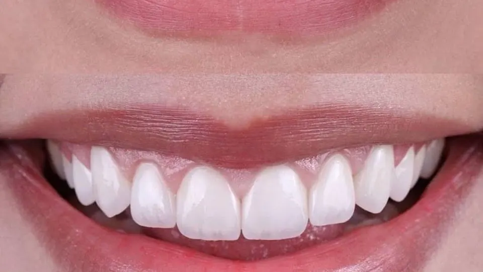 NÜVA Smile - Dentist in Newark, NJ