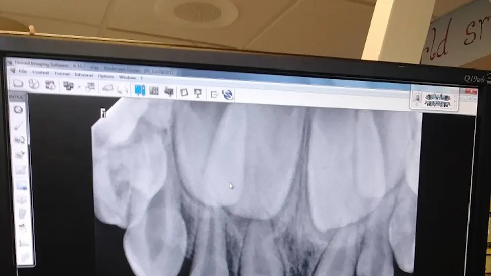 Pediatric Dentistry - Dentist in Eau Claire, Wisconsin