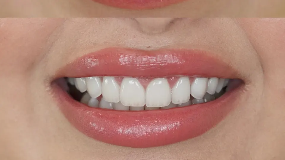 Seviin Cosmetics - Dentist in Houston, TX