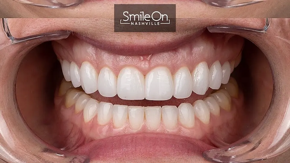 Smile On Nashville - Cosmetic dentist in Nashville, TN