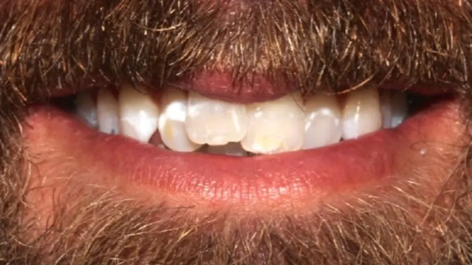 StoneCreek Dental Care - Birmingham Montclair - Dentist in Birmingham, AL