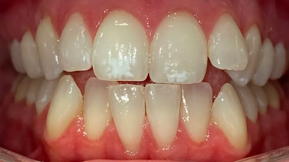 Team Dental - Northern Liberties - Dentist in Philadelphia, PA