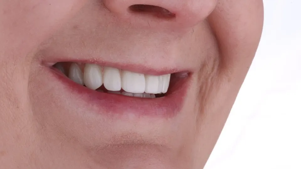 The Dental Center of Manchester - Dental implants provider in Manchester, NH