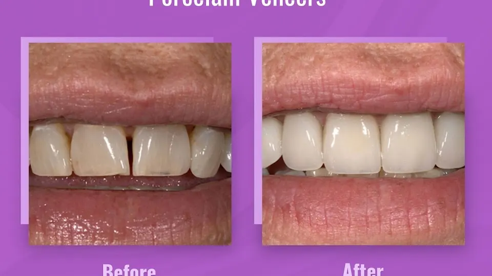 Thomas Smile Designs - Dentist in Billings, MT
