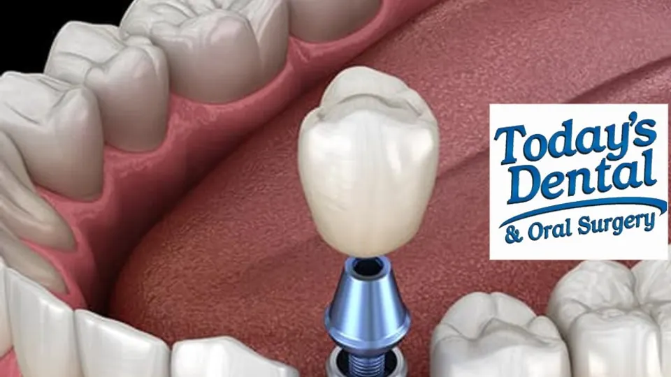 Today's Dental and Oral Surgery - Dentist in Las Vegas, NV