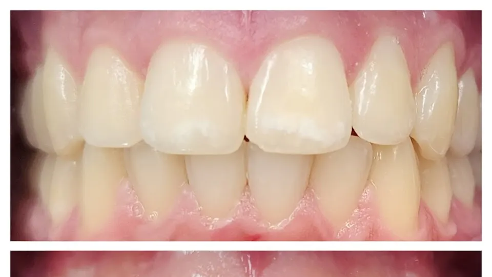 VS Dentistry - Cosmetic dentist in New York, NY